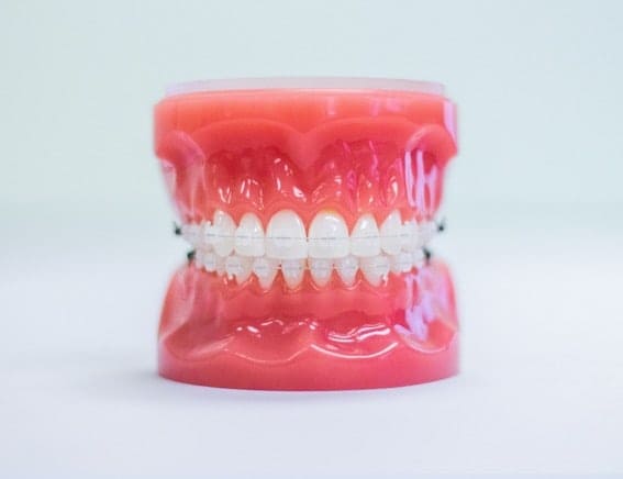 spring arbor orthodontics