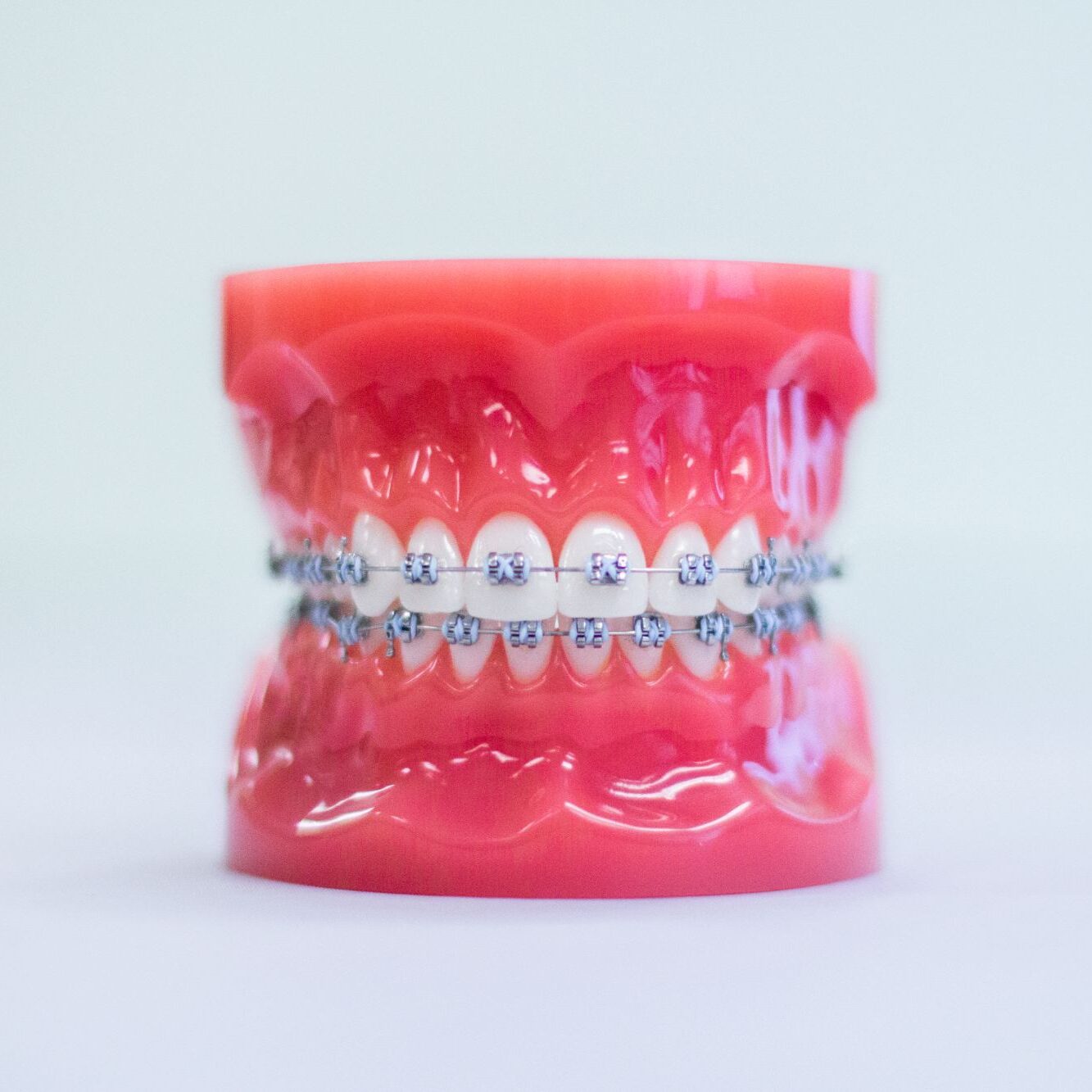 braces charlotte mi